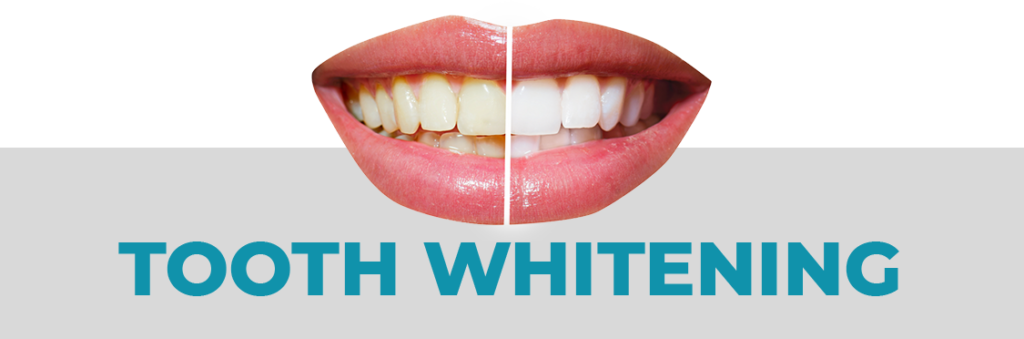 teeth whitening dentist clinic kandivali