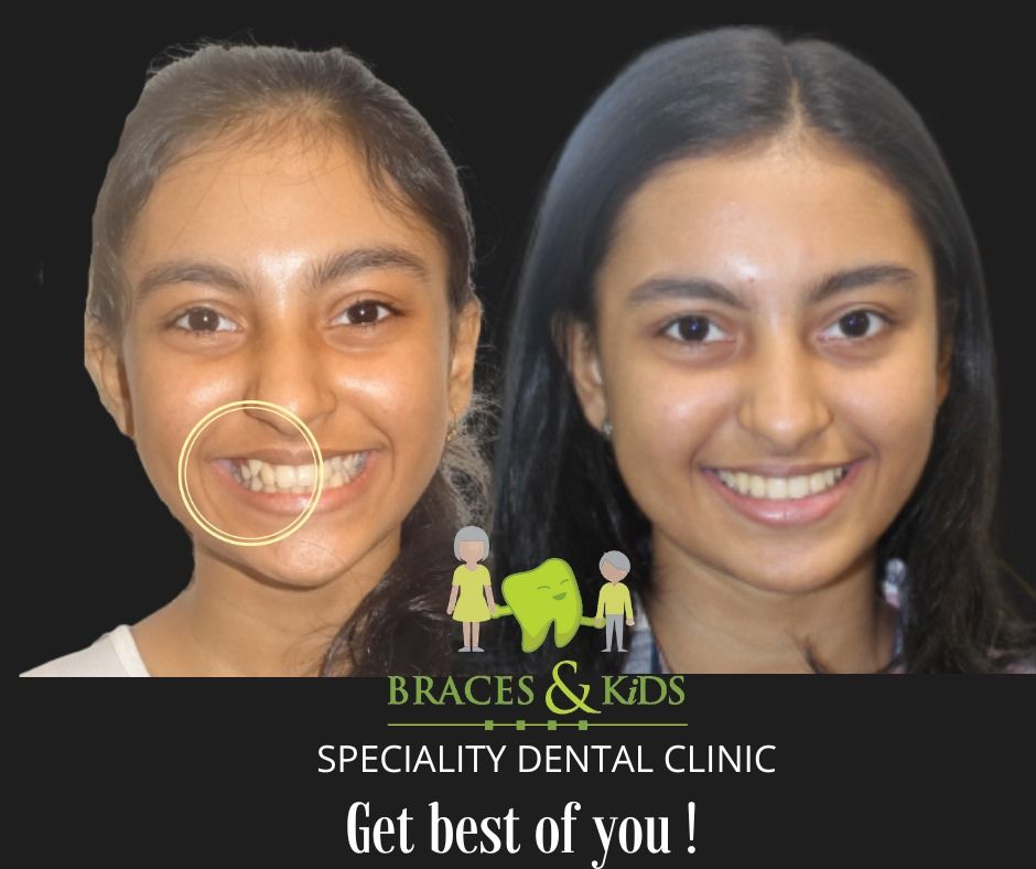 pediatric dentist mumbai